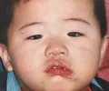 member face